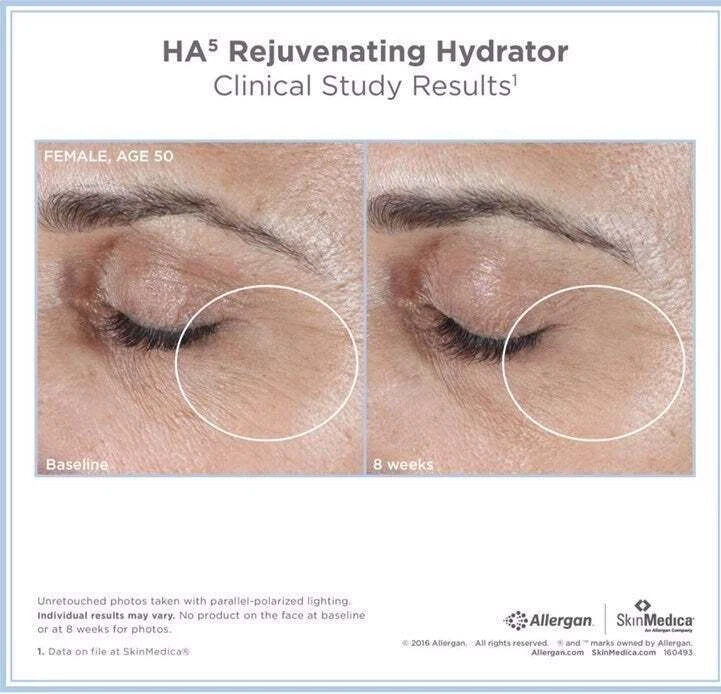 New Sealed SkinMedica HA5 Rejuvenating Hydrator 2 oz Authentic Hyaluronic Serum